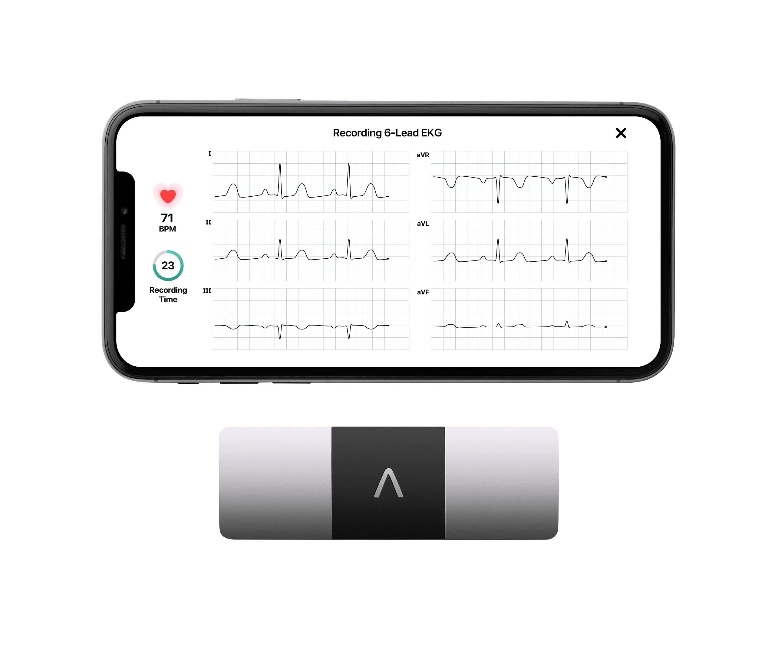 KardiaMobile 6L Persönlicher EKG-Monitor für Smartphones