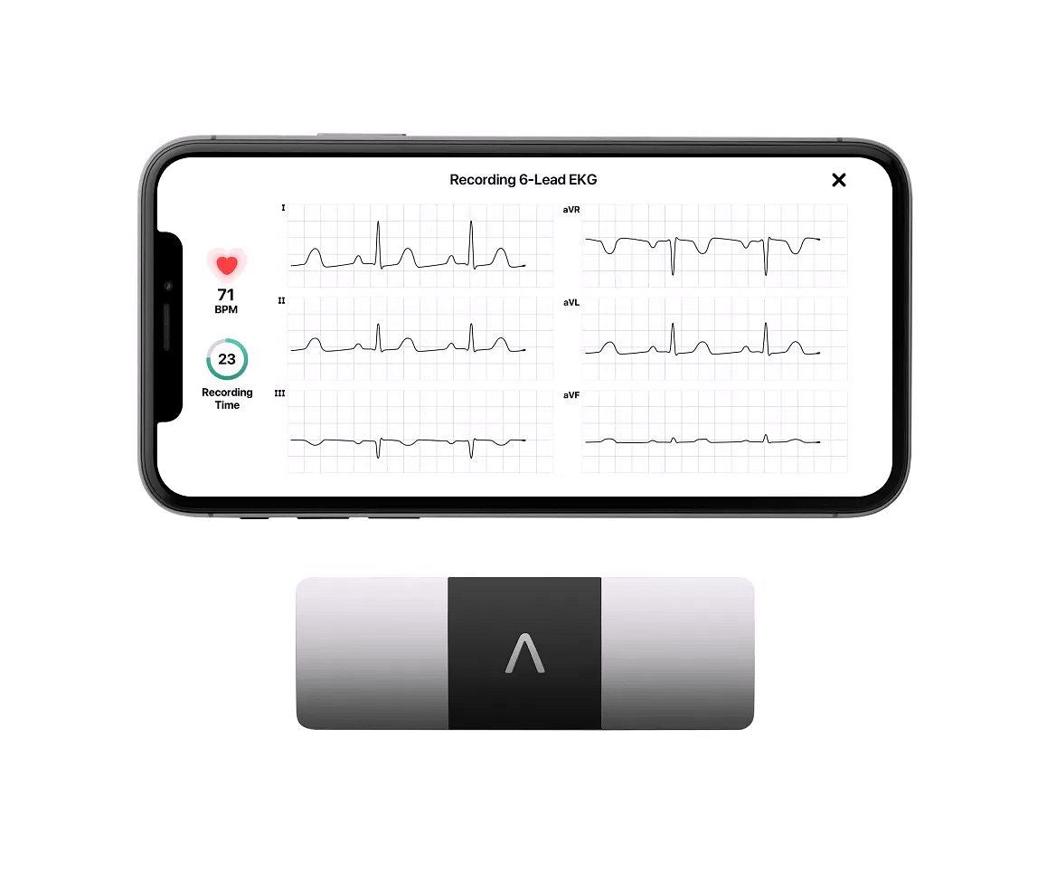 KardiaMobile 6L Persönlicher EKG-Monitor für Smartphones